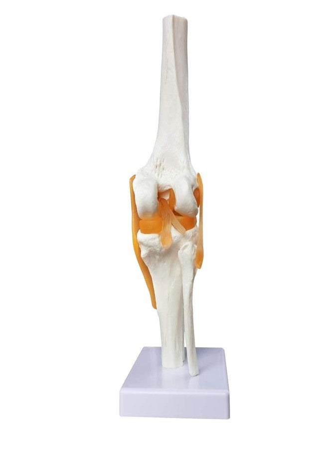 EVOTECH SCIENTIFIC Human Functional Knee Joint Model, with Ligament, Life Size for Medical Teaching Learning, Clinic Demonstration, Students Learning Education Display Tool - Image 2